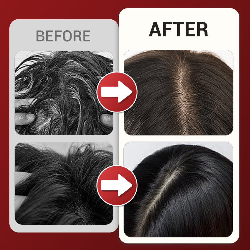 💆‍♀️🌟Multi-function Head Massage Comb🔄 Deep Relaxation, Scalp Care, One-Touch Comfort Experience!